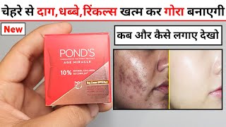 Ponds Age Miracle Day Cream | ponds age miracle day cream spf 15 | ponds age miracle cream