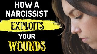 How a Narcissist Exploits Your Wounds & How to Safeguard from It