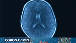 Patients, doctors try to understand 'brain fog' symptom associated with COVID-19