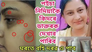 ডাক্তৰৰ পৰামৰ্শ আৰু মুখৰ যত্ন কিদৰে মই ঘৰতে বহি লাভ কৰিছোঁ | আপোনিও পাৰিব ঘৰতে বহি | Assamese vlog