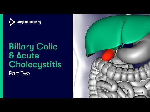 Colic In Adults - Biliary Colic | Renal Colic