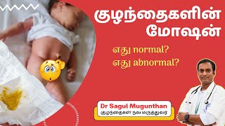 குழந்தைகளின் மோஷன்- எது normal? எது abnormal? | Paediatrician Tips