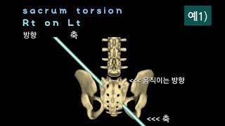 천골 움직임, sacrum movement, sacrum torsion