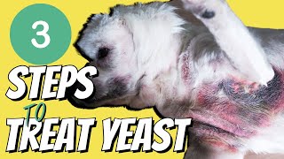 Top 3 Steps to Stop the Itching caused by Yeast