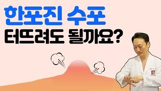 한포진(pompholyx) 수포 터뜨려도 될까요?