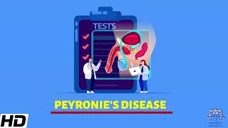 Peyronie's Disease: Everything You Need To Know