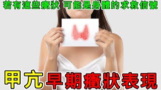 【健康】甲亢的早期症状表現有哪些？#健康 #養生 #科普 #涨知识 #知識