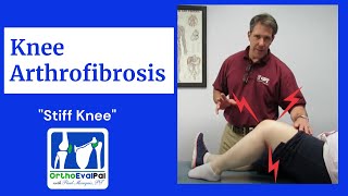 How to Treat an Arthrofibrotic Knee in Physical Therapy