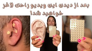 آموزش صفر تا صد استفاده ار چسب لاغری گوش/ معجزه ی لاغری با طب سوزنی گوش