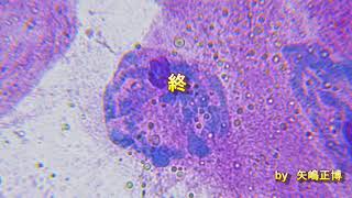 唾腺染色体の観察実験（ユスリカ）　高校生物実験