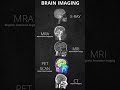 brain imaging xray mra ct scan pet scan mri brain medical xray