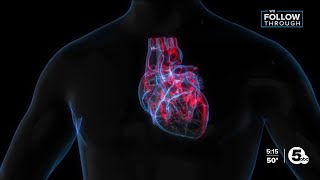 New UH study shows decline in heart disease deaths in Portage County