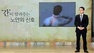 근육통에 시달리는 남편 ‘노안의 신호’ @좋은아침 4839회 20160426