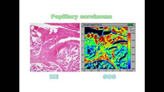 Scanning acoustic microscopy of thyroid - Video abstract