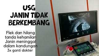 Tanda janin tidak berkembang (USG part)