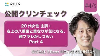 20代女性、主訴：右上の八重歯と重なりが気になる、歯ブラシがしづらいパート4