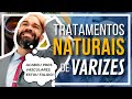 🔴 Tratamento NATURAL ou CASEIRO para Varizes existe?