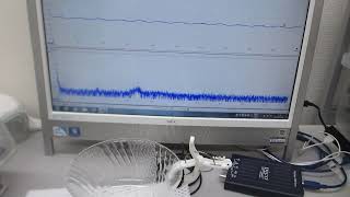 超音波プローブの伝搬特性を測定・解析・評価する技術の応用（超音波システム研究所）