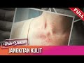 Helo Doktor (2021) | Jangkitan Kulit (Sun, Aug 22)