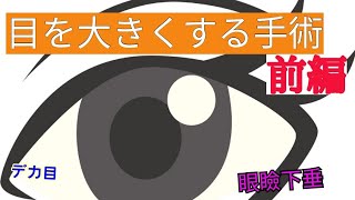 【デカ目】眼瞼下垂の手術について前編）【眼瞼下垂】