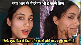 😱 चेहरे के काले तिल हो जायेंगे एक दिन मै ठीक , सिर्फ घरेलू नुस्खे से गारंटी है 💯 #skincare #skinc