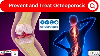 Prevent Osteoporosis NATURALLY! 10 Tips You NEED to Know (2024)