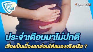 ประจำเดือนมาไม่ปกติ เสี่ยงเป็นเนื้องอกต่อมใต้สมองจริงหรือ ? | รู้ทันกันได้