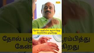 தோல் பகுதியில் ஆரம்பித்து கேன்சரில் முடிகிறது#yogam vloggers shorts #