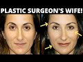 Facial Fat Transfer Before & After: Look 10 Years Younger with Facial Fat Transfer