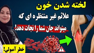 هشدار لخته خون: علائم خطرناک لخته های خون که ممکن است از دست بدهید! علائم اولیه آمبولی