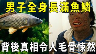 因果不饒人！男子全身長滿魚鱗，受盡歧視，幕後真相揭開，只因父母種下這樣可怕的業因！【曉書說】