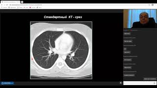 Лучевая диагностика легких