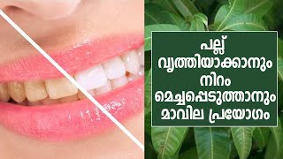 Mango Leaf Paste To Clean Your Teeth | പല്ലുകൾ ഇനി മാവില കൊണ്ട് വൃത്തിയാക്കാം