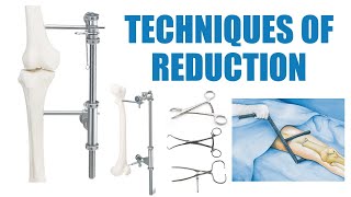 Skills Lab : Techniques of reduction