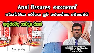 Anal fissures  | පරිකර්තිකා  රෝගයට නොවරදින ආර්යුවේද පිළියම්  | Dr.Abhayathilaka Dewagiri