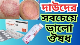 দাদ ও চুলকানি দূর করার উপায় । দাউদের সবচেয়ে ভালো ঔষধ। দাউদের চিকিৎসা ও প্রেসক্রিপশন । Ringworm