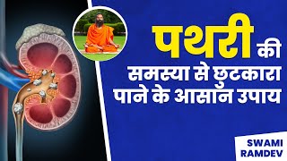 पथरी की समस्या (Stone Problem)  से छुटकारा पाने के आसान उपाय || Swami Ramdev