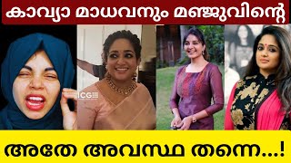 💢KAVYA MADHAVAന്റെ ഗതിയും അവസാനം അത് തന്നെ❌| ചക്കിയുടെ കല്യാണത്തിന് കാവ്യ പറഞ്ഞത് 100% ശെരിയാണ്🫤