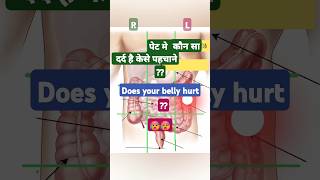 पेट मे कौन सा दर्द है केसे पहचाने।Abdominal pain Differential Diagnosis #trending #shortsfeed #short