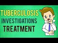 Tuberculosis(TB) Treatment,Symptoms,TB Screening,PPD test,Tuberculosis Infection Diagnosis USMLE