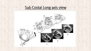 Pediatric Echo for the Adult Technologist: The Views