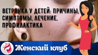 Ветрянка у детей: причины, симптомы, лечение, профилактика