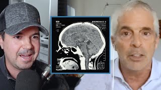 LEAKY GUT Leads to LEAKY BRAIN | Dr. Tom O'Bryan