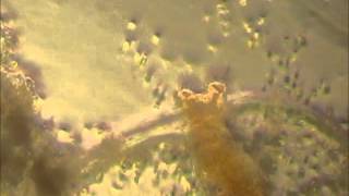 Microscopic Pond Creature - Mr. Motor Mouth