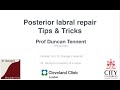 Posterior labral repair Tips and Tricks