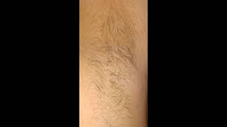 Armpit hair growth in 30 days (timelapse)