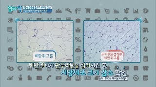 지방세포 크기를 작게(!) '핑거루트=다이어트' 상관관계 TV정보쇼 알짜왕 64회