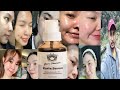 Jiore Kuria Serum | Honest Review