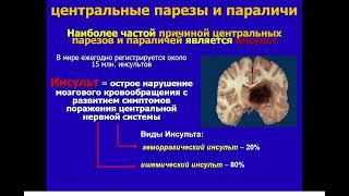 9.50 медицинская реабилитация в неврологии