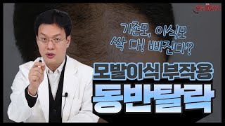 모발이식 부작용 [동반탈락] 기존모,이식모 싹 다 빠졌다고요?